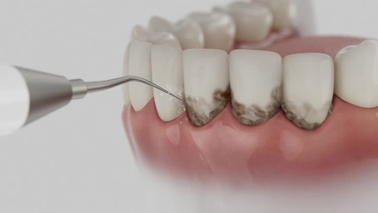 Trusted Wisdom Tooth Removal service in Holton, KS - Dentist Open Now